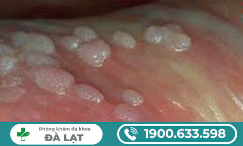 Hình ảnh minh họa